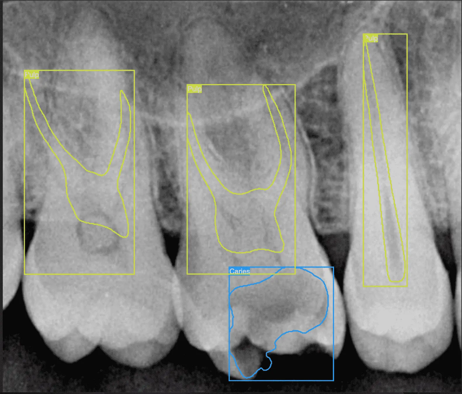 Endodontics