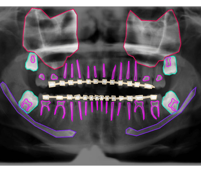 Orthodontics